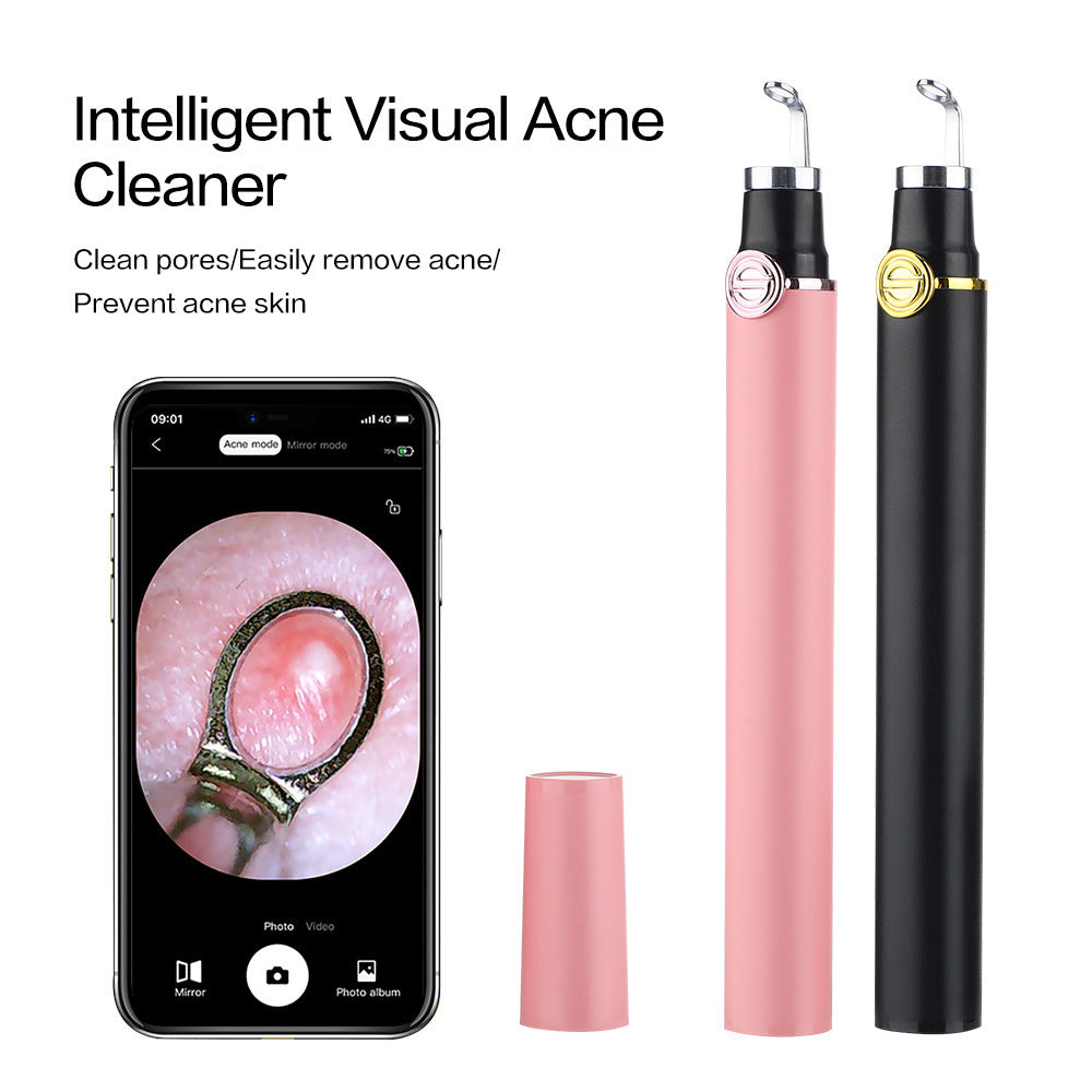 Smart Pore Vacuum Cleaner | Visual Blackhead Remover & Acne Extractor (Pink)