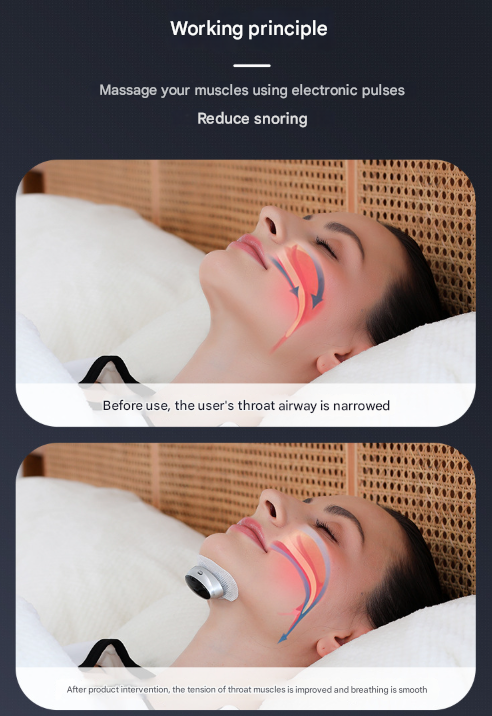 Smart Anti-Snoring Device | Rechargeable Pulse Throat Stimulator for Better Sleep (Black)