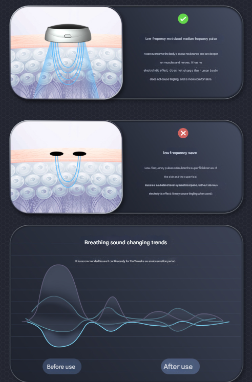 Smart Anti-Snoring Device | Rechargeable Pulse Throat Stimulator for Better Sleep (Black)